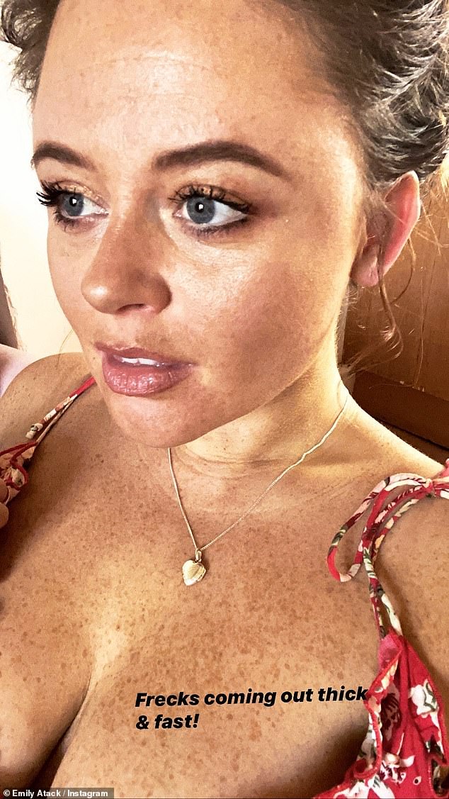 aisha noor recommends freckled tits pic