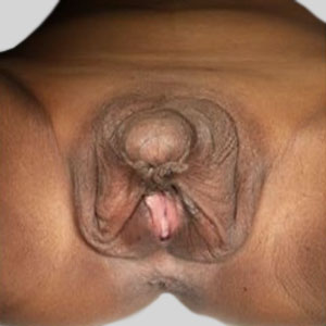 pictures of a large clitoris